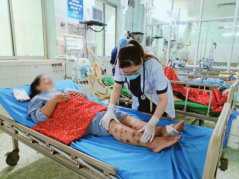 Nữ bệnh nhân xuất hiện các đốm đen ở chân sau khi tiêm canxi. Ảnh: BVĐK Tuyên Quang