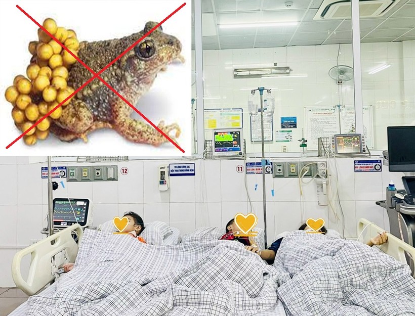 Ba mẹ con ở Phú Thọ phải nhập viện cấp cứu vì ngộ độc thịt và trứng cóc. Ảnh: BVĐK tỉnh Phú Thọ