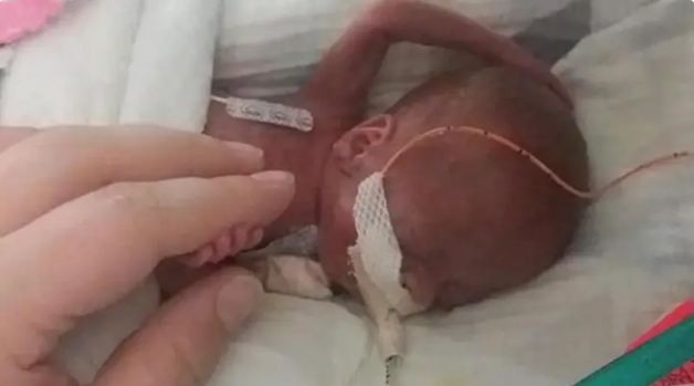 Em bé sinh non nặng hơn 300 gram đã sống sót một cách thần kỳ.
