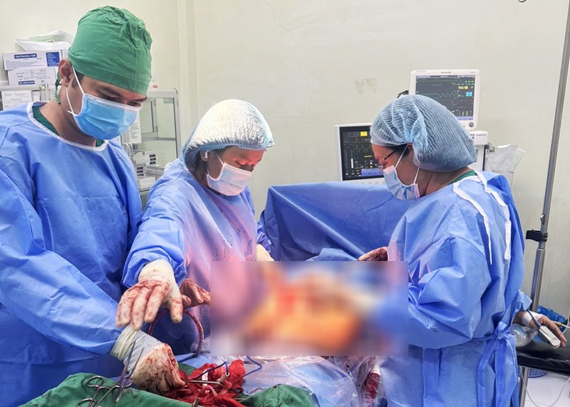 Các bác sĩ phẫu thuật thành công lấy khối u khủng cho nữ bệnh nhân.