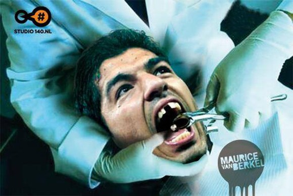 Luis Suarez tổn thương răng miệng