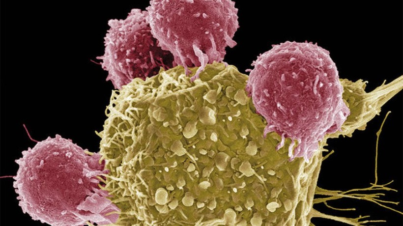 Các tế bào T đang tấn công tế bào ung thư