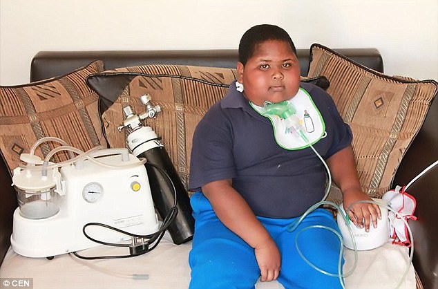 Mới 10 tuổi cậu bé này đã nặng gần 100kg, ăn cả giấy vệ sinh vì không thấy no 