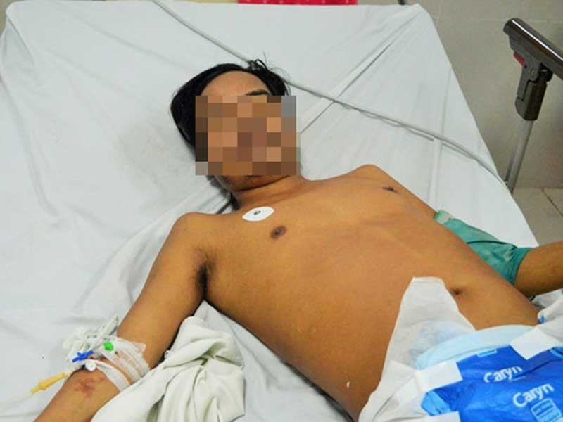 Anh Thân sau khi được các bác sĩ Bệnh viện Hữu nghị Việt Nam – Cu Ba – Đồng Hới tiến hành phẩu thuật cắt bỏ chân phải đã bị hoại tử do rắn cắn.