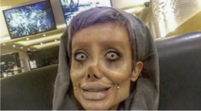 Cô gái phẫu thuật thẩm mỹ hơn 50 lần để nhìn giống Angelina Jolie, kết quả trả về gia tinh Dobby