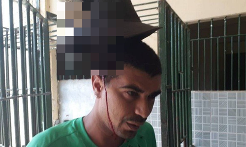 Người bị dao cắm vào đầu vẫn tỉnh táo nói chuyện ở Brazil
