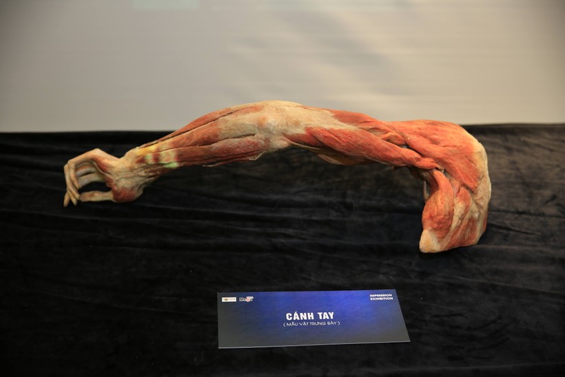 Triển lãm dự kiến trưng bày khoảng 131 mẫu vật cơ thể người thật

