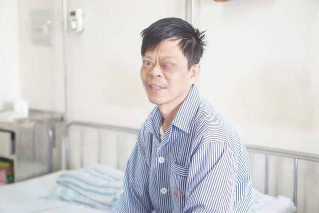 Chủ quan với bệnh bướu cổ, một bệnh nhân bị loét giác mạc, mất thị lực hoàn toàn