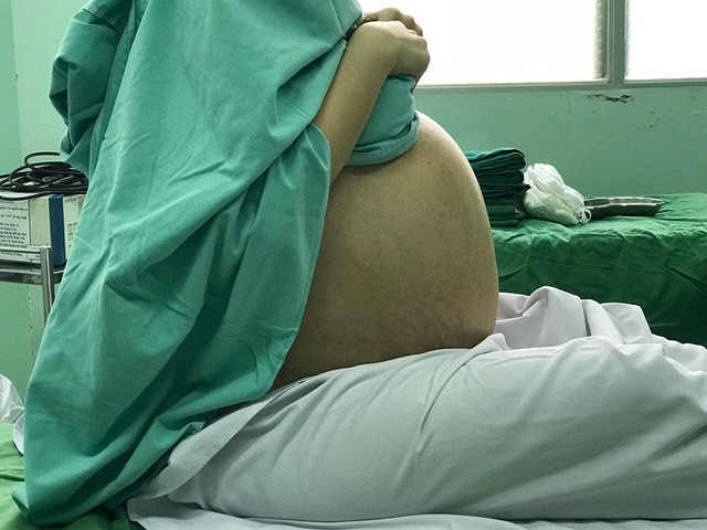 Cô gái trẻ chưa chồng mang khối “thai giả” nặng 17kg