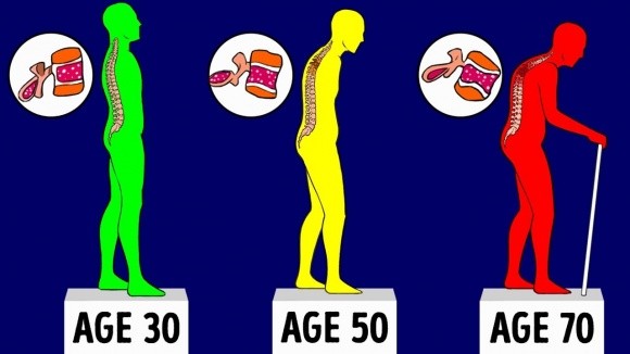 Để xương chắc khỏe khi ở độ tuổi 60 thì ngay độ tuổi 20, 30 bạn cần lưu ý những điều sau 
