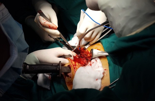 Cân não giành lại sự sống cho bệnh nhân bị dao cắm xuyên ngực