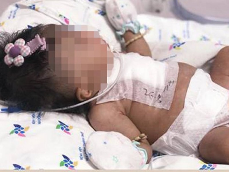 Bé gái sinh non nặng 2kg bị đa dị tật tim hồi sinh kỳ diệu