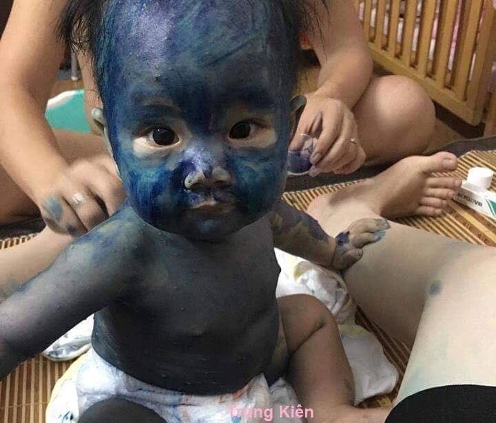 Em bé xanh "toàn thân" đáng yêu gây sốt cộng đồng mạng