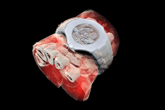 Hình ảnh scan 3D cổ tay của TS Vật lí học Phil Butler, bao gồm cả đồng hồ đeo tay của ông, được thực hiện trên máy scan mới do chính ông và con trai Anthony Butler (một nhà khoa học về X- quang) phát triển lên