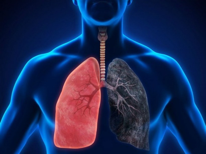 Kim loại nặng gallium có thể chữa khỏi nhiễm trùng phổi nguy hiểm