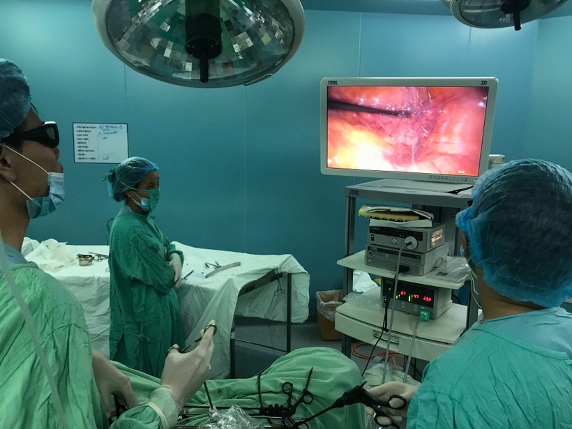 Ê kíp bác sĩ đang tiến hành ca phẫu thuật nội soi 3D để treo tử cung vào mỏm nhô