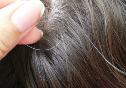 Mái tóc tiết lộ vấn đề sức khỏe của bạn