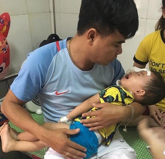Bé 2 tuổi ở Nghệ An bị chó becgie cắn tổn thương mặt