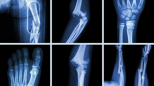 5 sự thật về xương người ai cũng tưởng đúng nhưng hoá ra lại sai bét