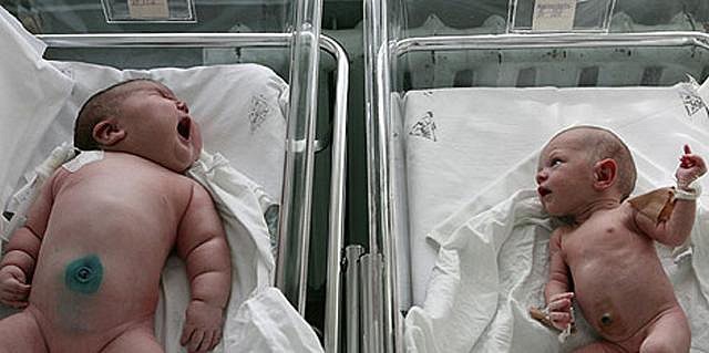 Mẹ chỉ ăn mì và khoai, bé nữ sinh ra nặng 7,7 kg khiến bác sĩ sốc nặng