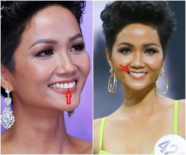 Cận cảnh nhan sắc các nàng hậu Việt sau khi từ bỏ răng khểnh