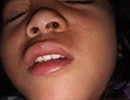 Mẹ bàng hoàng phát hiện pin kẹt trong mũi con 5 tuổi suốt 4 ngày