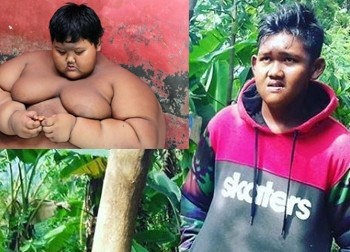 Quá trình giảm cân đáng kinh ngạc của cậu bé béo nhất thế giới