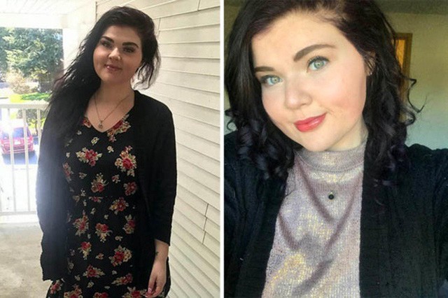 Cô gái béo phì từng nặng 160 kí giảm cân ngoạn mục, tìm lại tự tin