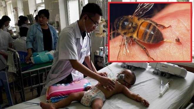 Cứu sống cháu bé 19 tháng tuổi bị hơn 1 nghìn vết ong đốt   