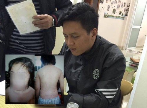 Đề nghị truy tố bố đẻ và mẹ kế bạo hành dã man con trai 10 tuổi ở Hà Nội