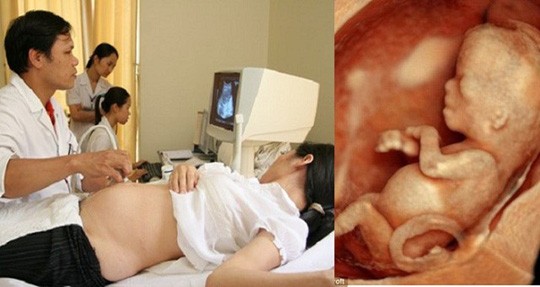 Mẹ bầu siêu âm nhiều có ảnh hưởng thai nhi không?