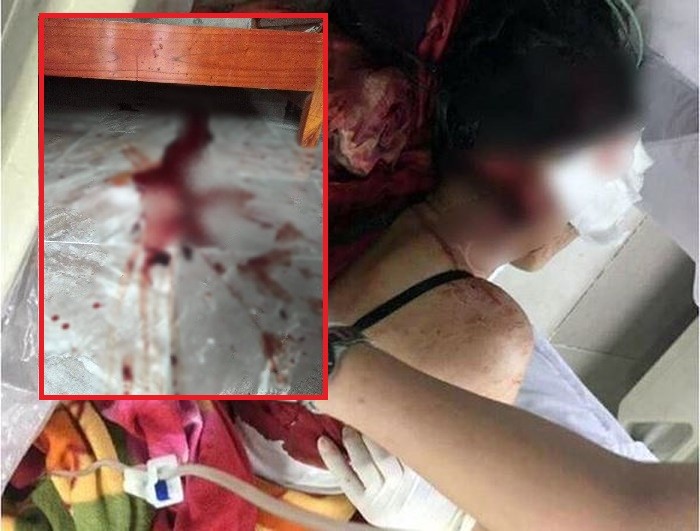 Tạm giữ người chồng dùng dao chém vợ trọng thương ở Phú Thọ