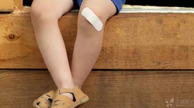 Sai lầm khi dùng miếng băng dán y tế, bé 4 tuổi bị cắt cụt đầu ngón tay 