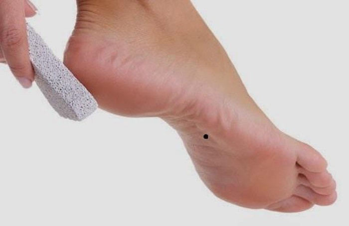 5 dấu hiệu “có của” ở bàn chân người phụ nữ, không tỷ phú cũng thành đại gia