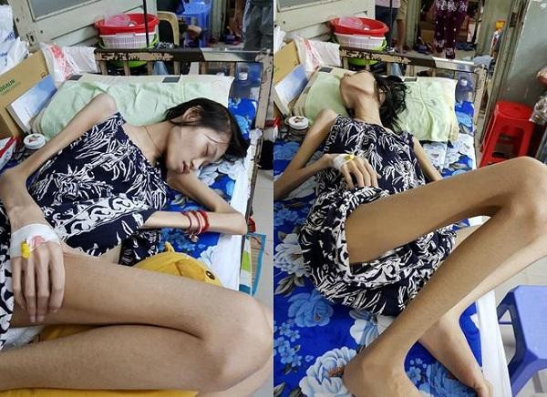 Phụ nữ có đặc điểm này dễ mắc bệnh khiến người mẫu Kim Anh qua đời 
