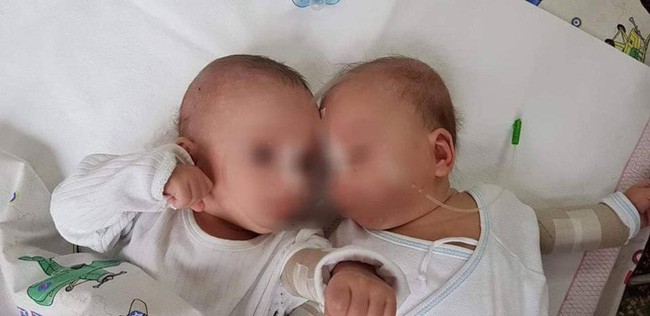 Sự thật gây sốc sau bức hình cặp song sinh 5 tháng tuổi bị trói chặt trên giường bệnh