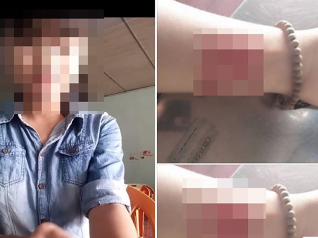Bị bạn trai phản bội, cô gái Sài Gòn dùng dao lam tự hủy hoại cơ thể