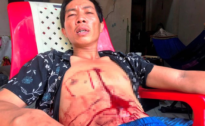 Vết thương trên ngực Nguyễn Hoàng Tâm chảy máu rất nhiều nhưng Tâm vẫn quyết không đến bệnh viện cấp cứu.