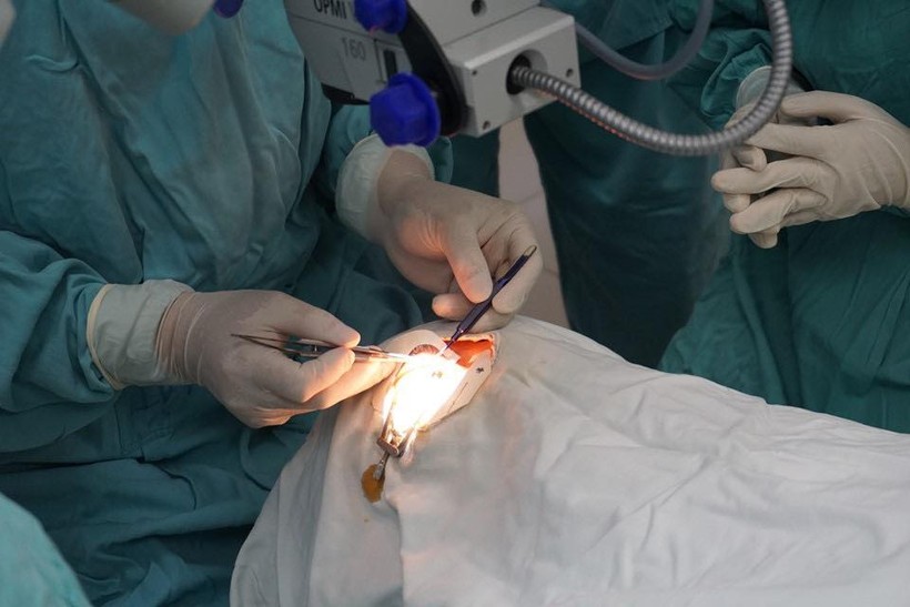 Đội ngũ y bác sĩ Trung tâm Mắt – Bệnh viện Trung ương Huế thực hiện khẩn trương ca phẫu thuật ghép giác mạc.