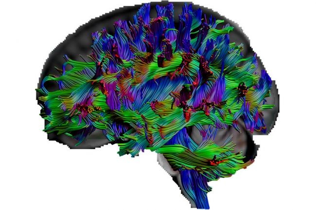 Sơ đồ hoạt động của não bộ được các nhà nghiên cứu định hình.