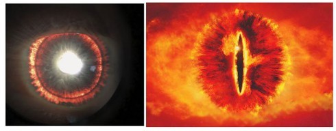 Mắc bệnh hiếm gặp, đôi mắt của người này làm chúng ta liên tưởng đến hình dạng của Sauron trong "Chúa tể những chiếc nhẫn" phiên bản điện ảnh. (Ảnh: Ars Technica).