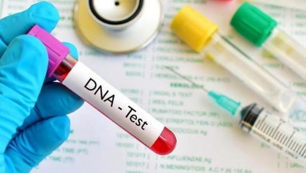 Tôi có nên cho cháu nội làm xét nghiệm ADN? (ảnh minh hoạ).
