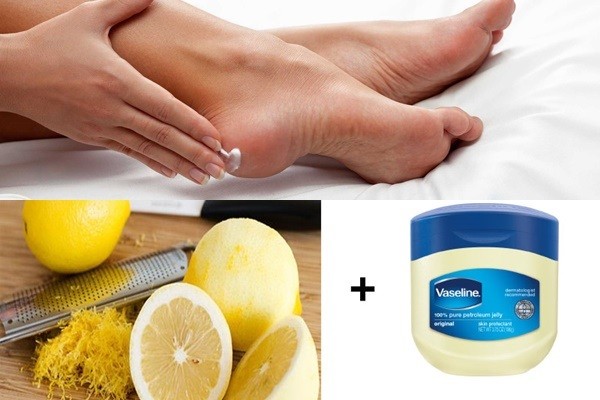 Mẹo trị nứt gót chân đơn giản và hiệu quả từ vaseline và chanh (Ảnh: Internet)