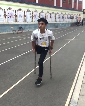 Nam sinh Trung Quốc cụt một chân vẫn thi chạy 1.000 m
