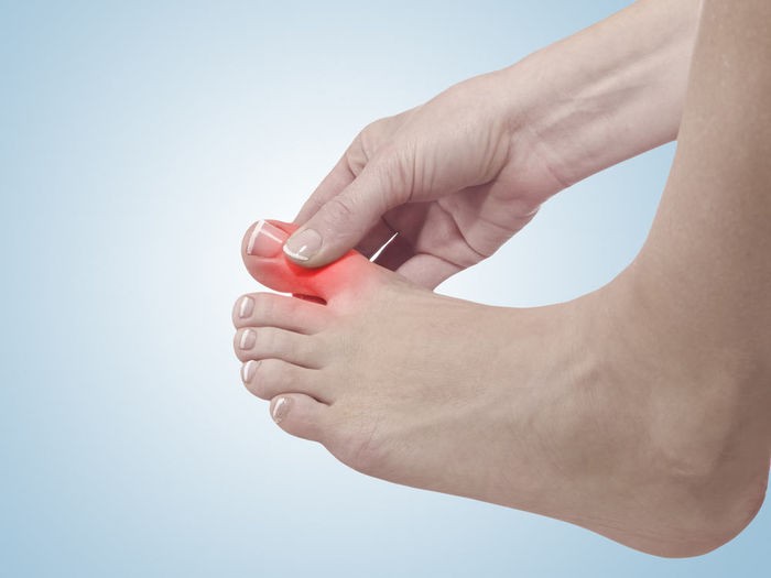 10 dấu hiệu trên bàn chân cảnh báo vấn đề nghiêm trọng về sức khỏe