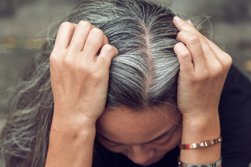 5 dấu hiệu khác thường trên mái tóc cảnh báo sức khỏe xuống cấp