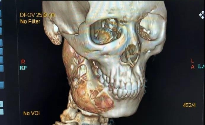 Kết quả chụp X-quang răng của Tiểu Mỗ.