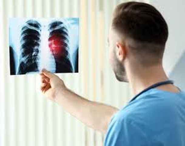 Nếu phát hiện được những dấu hiệu tổn thương phổi ở giai đoạn đầu, cần phải kịp thời đến bệnh viện để khám, có thể giảm thiểu tỉ lệ mắc bệnh ung thư phổi.