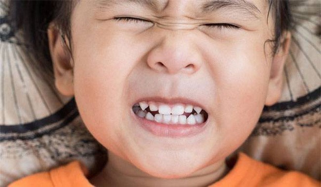 Một số người tin rằng nghiến răng khi ngủ là do sán dây gây ra. Song các bác sĩ thì nói rằng đó là bệnh bruxism ở trẻ em.